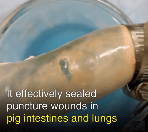 Bình xịt nhanh giúp làm nhanh vết thương ở phổi , ruột lợn