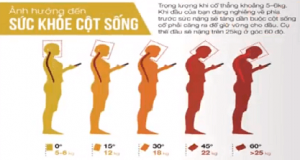 Cúi đầu ở nhiều góc ảnh hưởng đến cột sống khác nhau