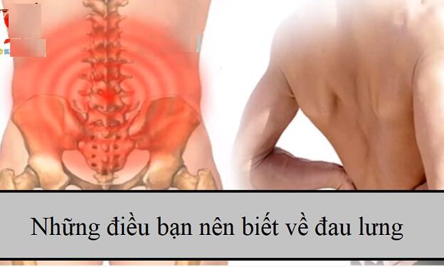 Nguyên nhân đau lưng