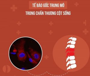 Điều trị chấn thương cột sống