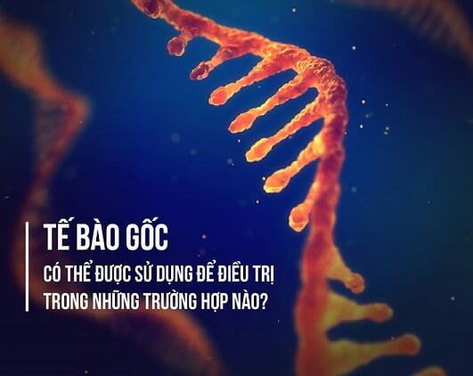 Phương pháp điều trị tế bào gốc