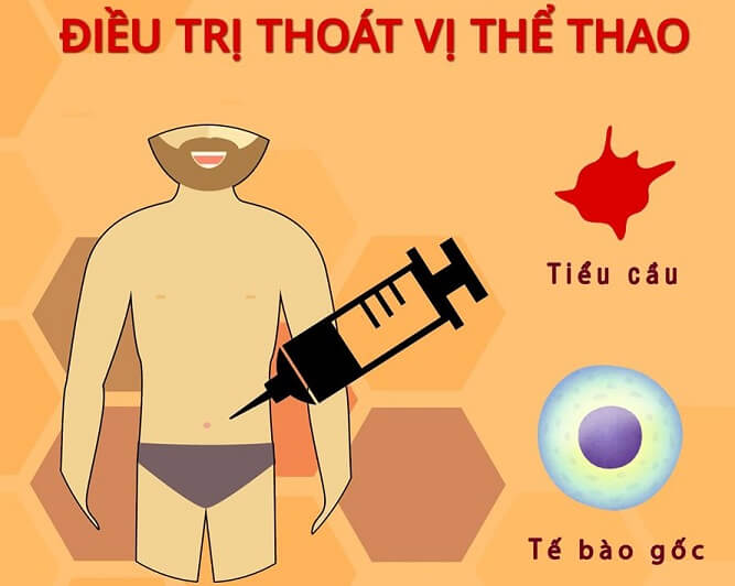 Điều trị thoát vị đĩa đệm