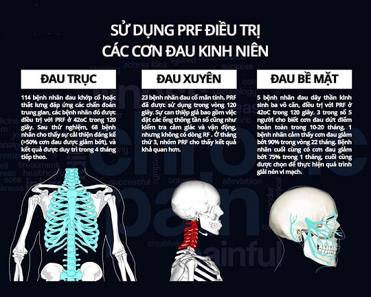Điều trị cơn đau