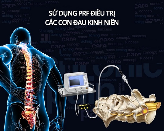 Điều trị đau mãn tính bằng tần số sóng