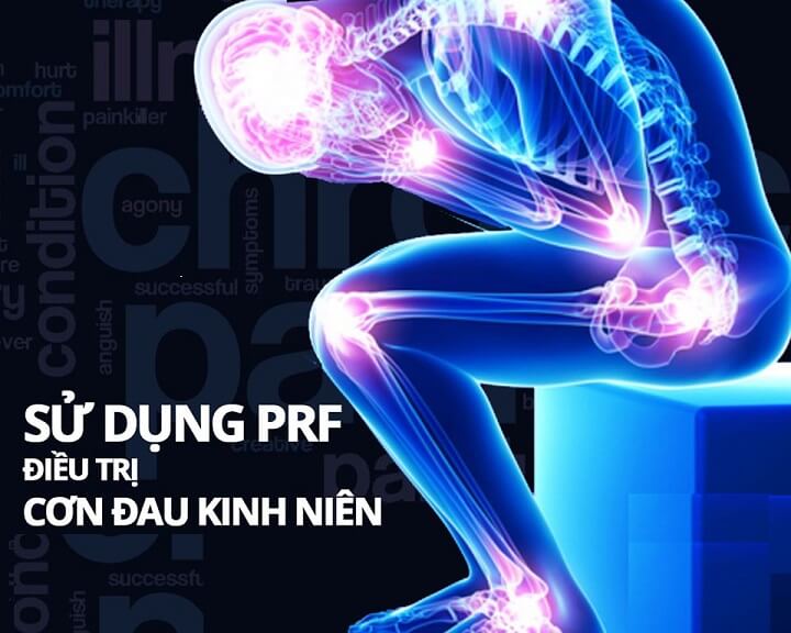 Phương pháp điều trị đau mãn tính