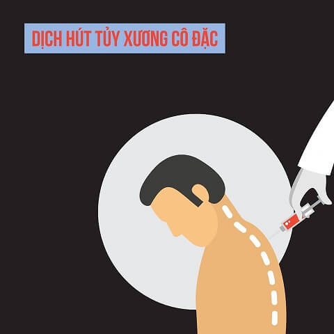 Dịch hút tủy xương cô đặc